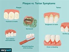 Image result for Dog Tooth Tartar