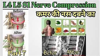 Image result for L5 Nerve Function