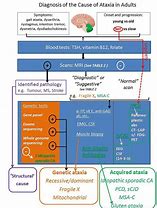 Image result for Acute Ataxia