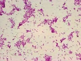 Image result for Mycobacterium GM's Stain