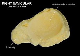 Image result for Talus Navicular