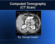 Image result for CT Scan PPT Template