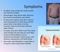 Image result for Klinefelter's Syndrome