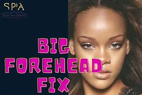 Image result for Big Forehead Lady