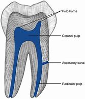 Image result for Pulp Anatomy