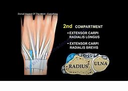 Image result for Dorsal Aspect Wrist