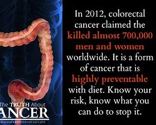 Image result for Cancer De Colon Tac