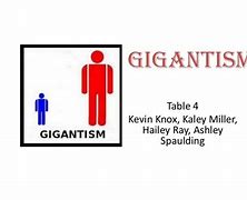 Image result for Example of Gigantism