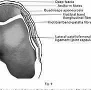 Image result for Lateral Ankle Retinaculum