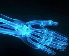 Image result for Bone Age Hand X-ray