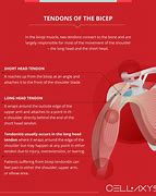 Image result for Shoulder Pain Treatment