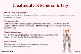 Image result for Femoral Blood Clot