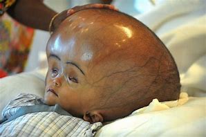 Image result for Big Head Baby Art