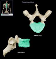 Image result for Dorsal Vertebrae