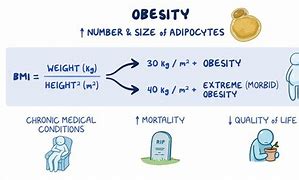 Image result for Obesity