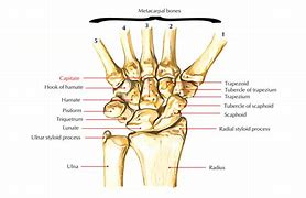 Image result for Capitate Bone Pain