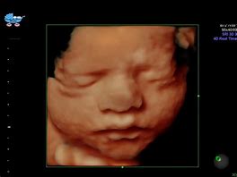 Image result for Baby Ultrasound Photo