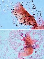 Image result for Common Bacteria