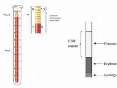 Image result for ESR Procedure