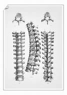 Image result for Dorsal Vertebrae