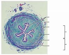 Image result for J-shaped Ureter