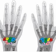 Image result for Capitate Bone Diagram