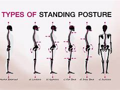 Image result for 5 Proper Standing Posture