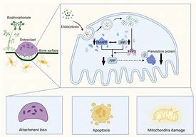 Image result for Bisphosphonate