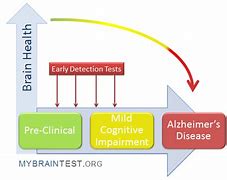 Image result for Dementia Albiro