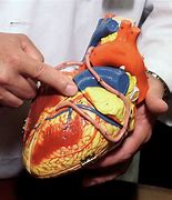 Image result for Heart Tumor/Cancer