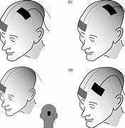 Image result for tDCS Placement Map