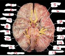 Image result for Cranial Nerves Number Diagram