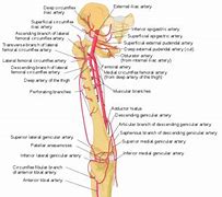 Image result for Femoral Blood Clot