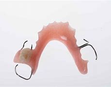 Image result for Acrylic Denture with Wrought Wire Clasps