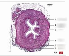 Image result for J-shaped Ureter