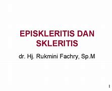 Image result for Skleritis