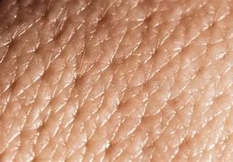 Image result for Macro Skin Pores