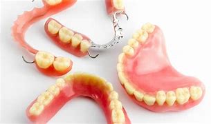 Image result for Partial Plate Dentures