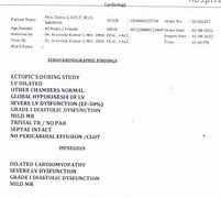 Image result for Dilated Cardiomyopathy EKG