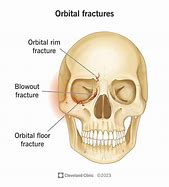 Image result for Orbital Rim Bones