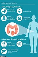 Image result for Colon Cancer Early Symptoms