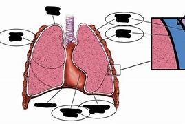 Image result for Pleural Linkage