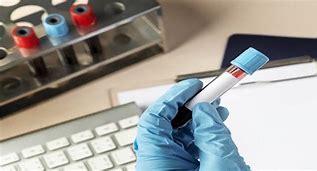 Image result for HLA A29 Blood Test