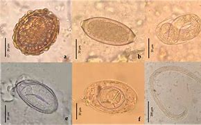 Image result for Ascaris Larvae