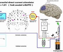 Image result for What Is a tDCS