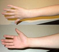 Image result for Volar and Dorsal Hand