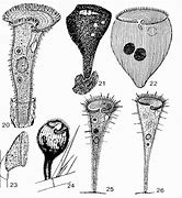 Image result for Stentor Protozoa