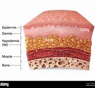 Image result for Dermis Skin Cut