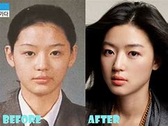 Image result for Jun Ji Hyun Plastic Surgery