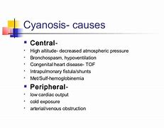 Image result for Cyanosis in Adults